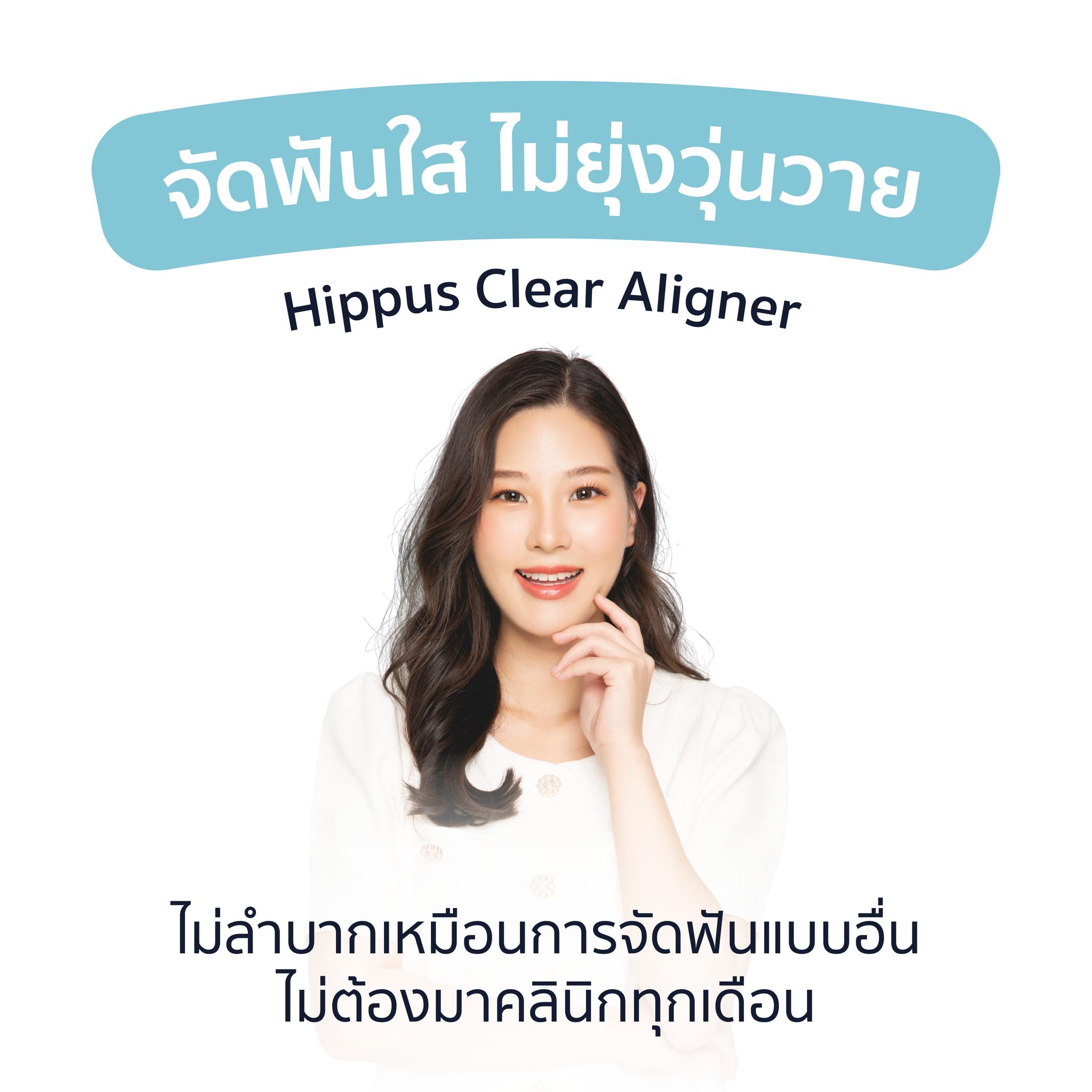 Read more about the article Hippus Clear Aligner ไม่ยุ่งวุ่นวายเหมือนการจัดฟันแบบอื่น